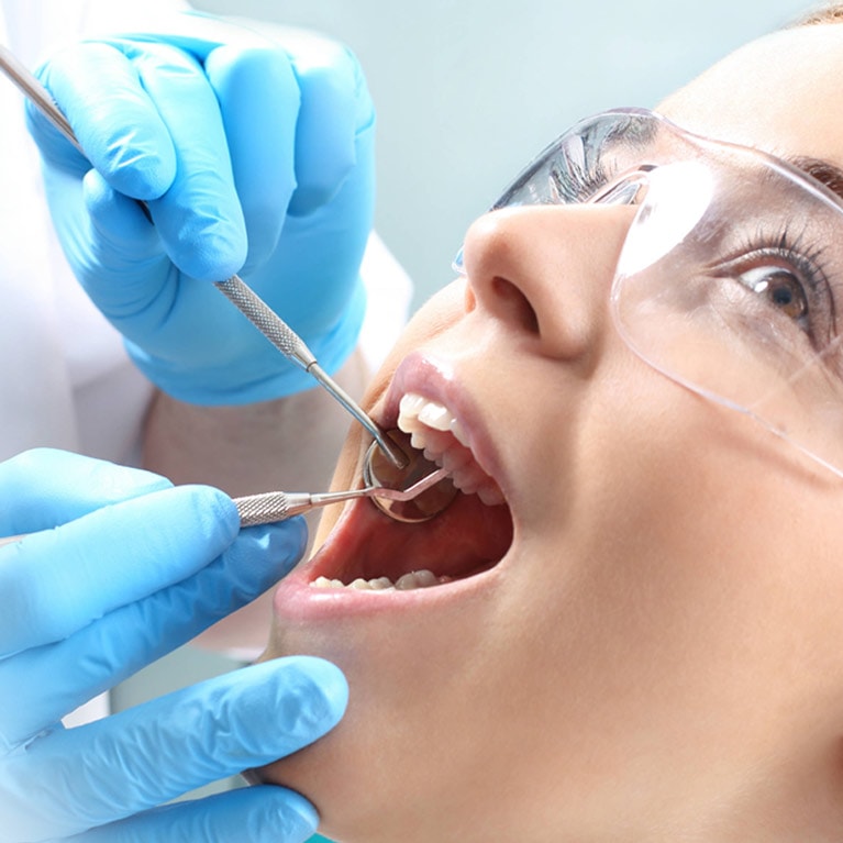 root canal singapore